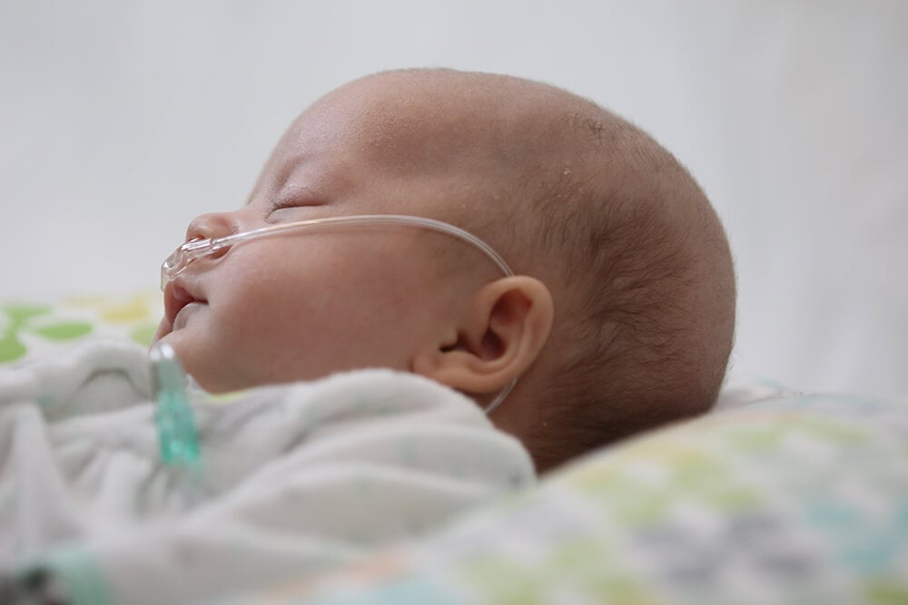 researchers-publish-approach-to-high-flow-nasal-cannula-in-neonates